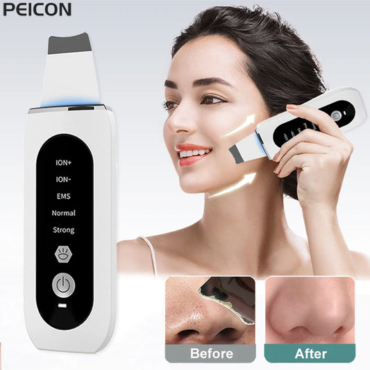 Shovel Skin Blackhead Ultrasonic Beauty Microcurrent Color Light